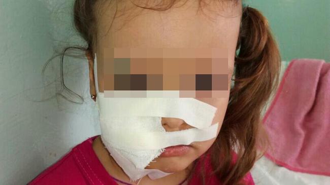 В детском саду под Челябинском собака покусала ребёнка за лицо