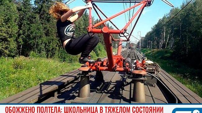 ⚡ Школьницу, получившую удар током во время селфи на крыше поезда, перевезли в Челябинск 