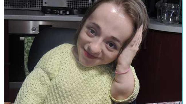 Девушка из Старокамышинска с болезнью "хрустального человека" нашла двойника в Испании