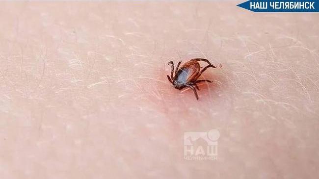❗️Челябинская область вошла в десятку регионов по числу укусов клещей