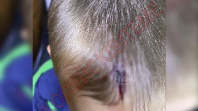 😰 В Копейске самокатчик сбил ребёнка