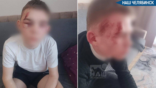 😱 В Чурилово жестоко избили 15-летнего подростка