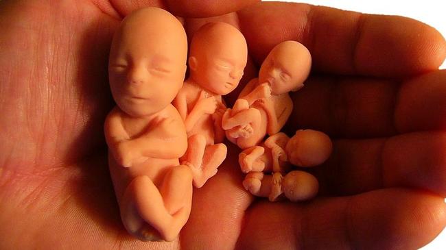 «Признать за зачатым ребенком статус человеческого существа». Патриарх Кирилл подписал обращение за полный запрет абортов в России