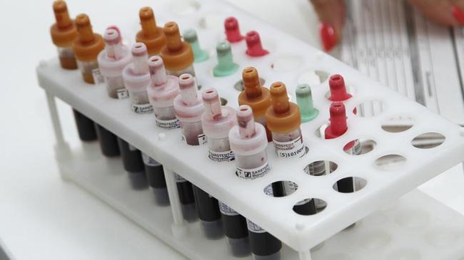 Бесплатный тест на ВИЧ и подарки: челябинцам флешмобом напомнят о контрацепции