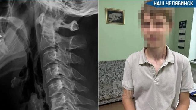 🚑 В Челябинске врачи спасли подростка после страшной травмы на мотоцикле