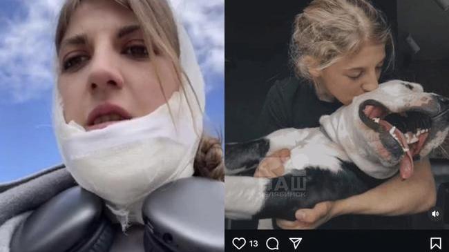 🐶 Собака напала на челябинку, разодрав ей шею