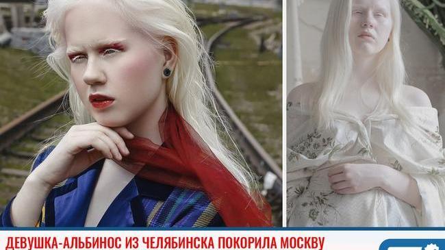 ⚡ Девушка-альбинос из Челябинска покорила Москву и участвует в модных фотосессиях