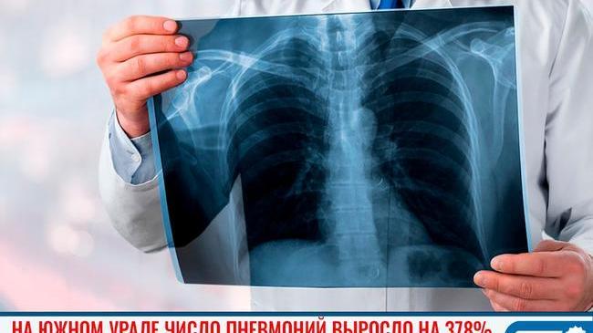 😷 В Челябинской области число пневмоний выросло на 378% по сравнению с прошлым годом 
