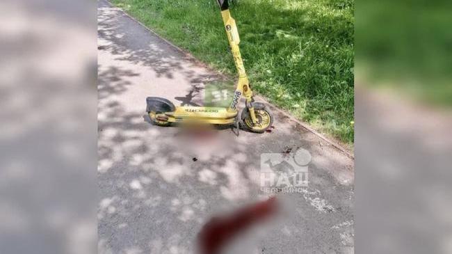 🚨 С самокатчика требуют 100 тысяч за сбитую пенсионерку