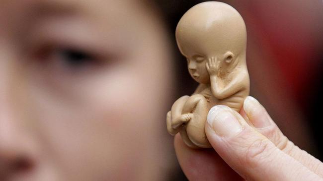В Минздраве предложили вывести аборты из общей лицензии на медпомощь