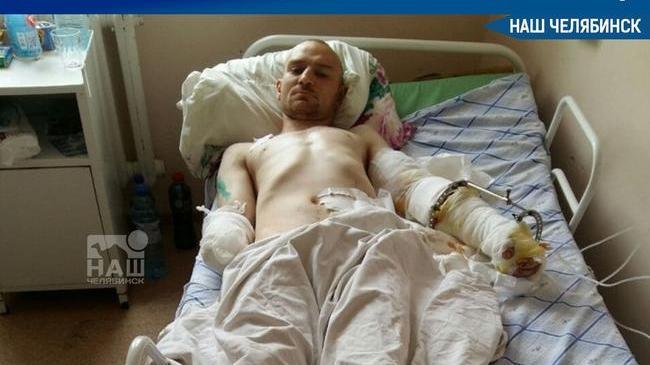 😰 Предпочла человека, а не корм: южноуралец остался без руки 