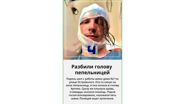 😱 В Челябинске артисту театра кукол разбили голову пепельницей