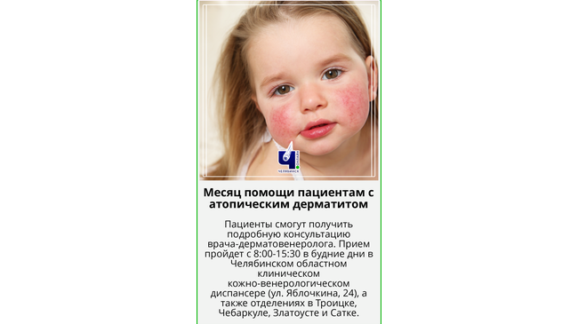 🏥 В Южноуральском КВД пройдет месяц помощи пациентам, страдающим атопическим дерматитом. 