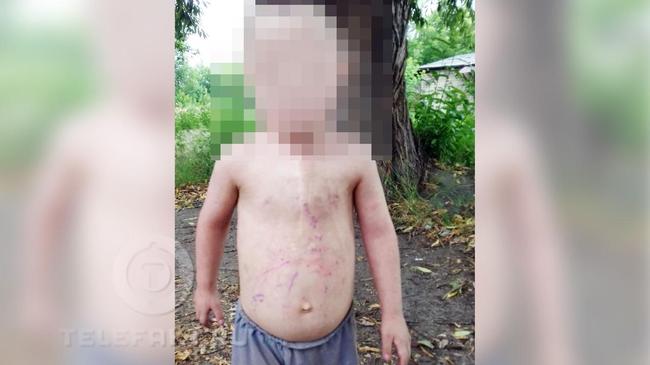 Южноуральцы обнаружили потерявшегося полуголого ребенка со шрамом на груди