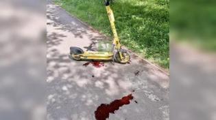 🤬 18-летний парень на самокате сбил пожилую женщину в Челябинске на улице Горького