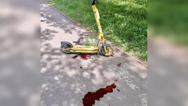 🤬 18-летний парень на самокате сбил пожилую женщину в Челябинске на улице Горького