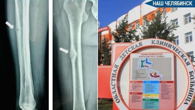 Помогли подростку с редким генетическим заболеванием