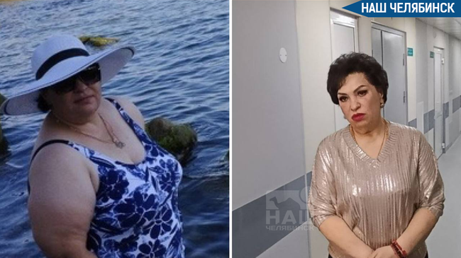 🧑‍⚕️ Челябинка сбросила вес и избавилась от диабета благодаря операции