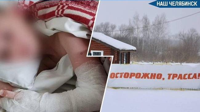 😨 В Челябинске семилетнего мальчика сбила «ватрушка» на базе отдыха на Шершнях