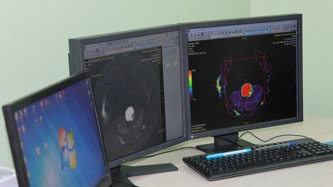 В ЧОКБ появились два уникальных аппарата – магнитно-резонансный томограф и мультиспиральный компьютерный томограф