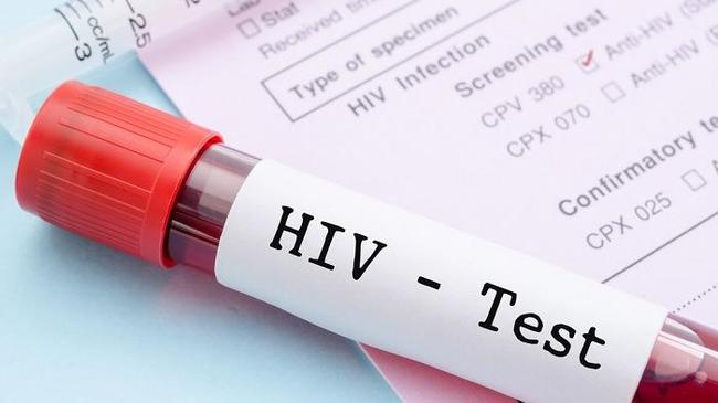 Более 4 тысяч зараженных в январе. Сразу после Дня всех Влюбленных южноуральцы сдадут тест на ВИЧ