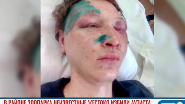 😱 В Челябинске в районе зоопарка неизвестные жестоко избили и ограбили аутиста 