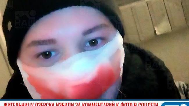 😱 Жительницу Озерска избили за комментарий к фото в соцсети 
