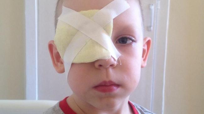 «Поиграется и перестанет»: маленький челябинец оказался в больнице после нападения питбуля