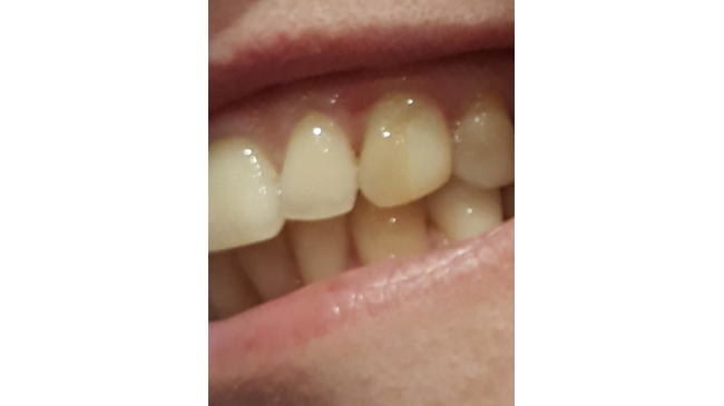  City Smile Стоматологическая клиника Челябинск, Братьев Кашириных, 99а — 1 этаж